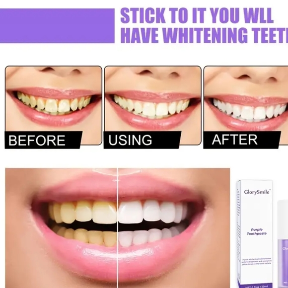NEW GLORYSMILE WHITENING TOOTHPASTE - Picture 3 of 4